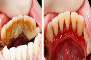 здрави зъби